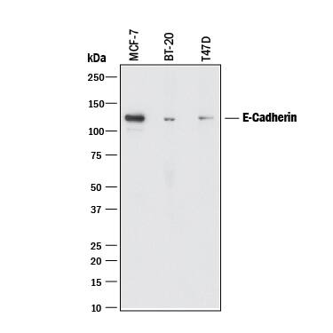 Western blot shows lysates of MCF-7 human breast cancer cell line, BT-20 human breast cancer cell line, and T47D human breast cancer cell line. PVDF membrane was probed with 2 µg/mL of Mouse Anti-Human E-Cadherin Monoclonal Antibody (Catalog # MAB18382) followed by HRP-conjugated Anti-Mouse IgG Secondary Antibody (Catalog # HAF018). A specific band was detected for E-Cadherin at approximately 120 kDa (as indicated). This experiment was conducted under reducing conditions and using Immunoblot Buffer Group 1.