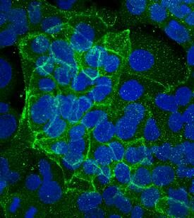 E-Cadherin was detected in immersion fixed PANC-1 human pancreatic carcinoma cell line using Mouse Anti-Human E-Cadherin Monoclonal Antibody (Catalog # MAB18383) at 10 µg/mL for 3 hours at room temperature. Cells were stained using the NorthernLights™ 493-conjugated Anti-Mouse IgG Secondary Antibody (green; Catalog # NL009) and counterstained with DAPI (blue). Specific staining was localized to plasma membrane. View our protocol for Fluorescent ICC Staining of Cells on Coverslips.