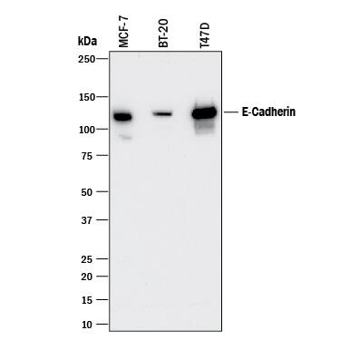 Western blot shows lysates of MCF-7 human breast cancer cell line, BT-20 human breast cancer cell line, and T47D human breast cancer cell line. PVDF membrane was probed with 0.5 µg/mL of Mouse Anti-Human E-Cadherin Monoclonal Antibody (Catalog # MAB18383) followed by HRP-conjugated Anti-Mouse IgG Secondary Antibody (Catalog # HAF018). A specific band was detected for E-Cadherin at approximately 120 kDa (as indicated). This experiment was conducted under reducing conditions and using Immunoblot Buffer Group 1.