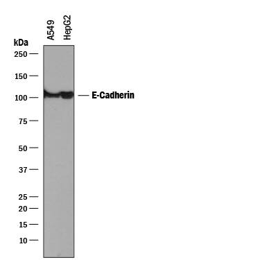 Western blot shows lysates of A549 human lung carcinoma cell line and HepG2 human hepatocellular carcinoma cell line. PVDF membrane was probed with 0.5 µg/mL of Mouse Anti-Human E-Cadherin Monoclonal Antibody (Catalog # MAB1838) followed by HRP-conjugated Anti-Mouse IgG Secondary Antibody (Catalog # HAF018). A specific band was detected for E-Cadherin at approximately 110 kDa (as indicated). This experiment was conducted under reducing conditions and using Immunoblot Buffer Group 1.