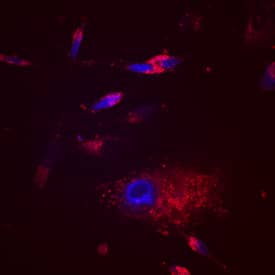 EDIL3 was detected in immersion fixed MDA-MB-231 human breast cancer cell line using Sheep Anti-Human EDIL3 Antigen Affinity-purified Polyclonal Antibody (Catalog # AF6046) at 10 µg/mL for 3 hours at room temperature. Cells were stained using the NorthernLights™ 557-conjugated Anti-Sheep IgG Secondary Antibody (red; Catalog # NL010) and counterstained with DAPI (blue). Specific staining was localized to cytoplasm. View our protocol for Fluorescent ICC Staining of Cells on Coverslips.
