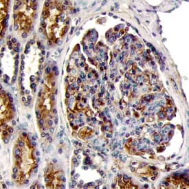 EDNRA was detected in immersion fixed paraffin-embedded sections of human kidney using Human EDNRA Monoclonal Antibody (Catalog # MAB6538) at 25 µg/mL overnight at 4 °C. Tissue was stained using the Anti-Mouse HRP-DAB Cell & Tissue Staining Kit (brown; Catalog # CTS002) and counterstained with hematoxylin (blue). View our protocol for Chromogenic IHC Staining of Paraffin-embedded Tissue Sections.