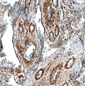 Immunohistochemistry EDNRB/Endothelin R Type B Antibody (671917) [Unconjugated]