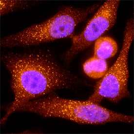 EEA1 was detected in immersion fixed HeLa human cervical epithelial carcinoma cell line using Sheep Anti-Human/Mouse/Rat EEA1 Antigen Affinity-purified Polyclonal Antibody (Catalog # AF8047) at 1.7 and 5 µg/mL for 3 hours at room temperature. Cells were stained using the NorthernLights™ 557-conjugated Anti-Sheep IgG Secondary Antibody (red; Catalog # NL010) and counterstained with DAPI (blue). Specific staining was localized to early endosomes. View our protocol for Fluorescent ICC Staining of Cells on Coverslips.