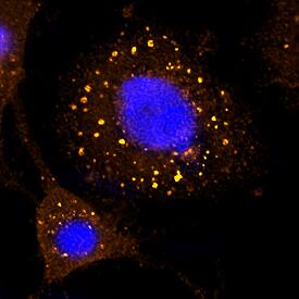 EEA1 was detected in formaldehyde fixed HeLa human cervical epithelial carcinoma cell line using Sheep Anti-Human/Mouse/Rat EEA1 Biotinylated Antigen Affinity-purified Polyclonal Antibody (Catalog # BAF8047) at 15 µg/mL overnight at 4 °C. Cells were stained using the NorthernLights™ 557-conjugated Streptavidin (orange; Catalog # NL999) and counterstained with DAPI (blue). Specific staining was localized to endosomes. View our protocol for Fluorescent ICC Staining of Cells on Coverslips.