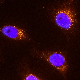 EEA1 was detected in immersion fixed HeLa human cervical epithelial carcinoma cell line using Mouse Anti-Human/Mouse/Rat EEA1 Monoclonal Antibody (Catalog # MAB8047) at 25 µg/mL for 3 hours at room temperature. Cells were stained using the NorthernLights™ 557-conjugated Anti-Mouse IgG Secondary Antibody (red; Catalog # NL007) and counterstained with DAPI (blue). Specific staining was localized to early endosomes in cytoplasm. View our protocol for Fluorescent ICC Staining of Cells on Coverslips.