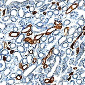 EGF was detected in perfusion fixed frozen sections of mouse kidney using Goat Anti-Mouse EGF Antigen Affinity-purified Polyclonal Antibody (Catalog # AF2028) at 5 µg/mL overnight at 4 °C. Tissue was stained using the Anti-Goat HRP-DAB Cell & Tissue Staining Kit (brown; Catalog # CTS008) and counterstained with hematoxylin (blue). Specific staining was localized to cytoplasm in convoluted tubules. View our protocol for Chromogenic IHC Staining of Frozen Tissue Sections.