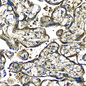 EGF was detected in immersion fixed paraffin-embedded sections of human placenta using Goat Anti-Human EGF Antigen Affinity-purified Polyclonal Antibody (Catalog # AF236) at 15 µg/mL overnight at 4 °C. Tissue was stained using the Anti-Goat HRP-DAB Cell & Tissue Staining Kit (brown; Catalog # CTS008) and counterstained with hematoxylin (blue). Specific staining was localized to syncytiotrophoblasts. View our protocol for Chromogenic IHC Staining of Paraffin-embedded Tissue Sections.