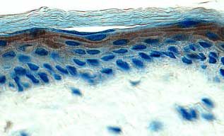 EGF was detected in immersion fixed paraffin-embedded sections of human skin using 25 &micro;g/mL Mouse Anti-Human EGF Monoclonal Antibody (Catalog # MAB236) overnight at 4 &deg;C. Tissue was stained with the Anti-Mouse HRP-DAB Cell & Tissue Staining Kit (brown; Catalog # CTS002) and counterstained with hematoxylin (blue). Specific labeling was localized to the cytoplasm of keratinocytes in the stratum granulosum in epidermis. View our protocol for Chromogenic IHC Staining of Paraffin-embedded Tissue Sections.
