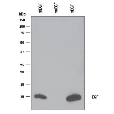 Western blot shows 100 ng of Recombinant Human EGF (Catalog # 236-EG), Recombinant Mouse EGF (Catalog # 2028-EG) and Recombinant Rat EGF (Catalog # 3214-EG). PVDF Membrane was probed with 1 µg/mL of Mouse Anti-Human EGF Monoclonal Antibody (Catalog # MAB236) followed by HRP-conjugated Anti-Mouse IgG Secondary Antibody (Catalog # HAF007). A specific band was detected for EGF at approximately 10 kDa (as indicated). This experiment was conducted under reducing conditions and using Immunoblot Buffer Group 3.