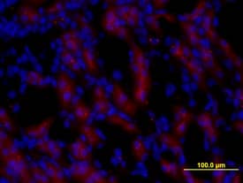 Pro Epidermal Growth Factor (Pro EGF) was detected in perfusion fixed frozen sections of mouse kidney using Rat Anti-Mouse Pro EGF Monoclonal Antibody (Catalog # MAB5256) at 10 µg/mL for 3 hours at room temperature. Tissue was stained (red) and counterstained with DAPI (blue). View our protocol for Fluorescent IHC Staining of Frozen Tissue Sections.