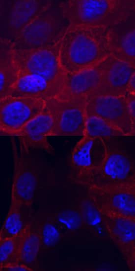 Immunocytochemistry EGFR [p Tyr1173] Antibody [Unconjugated]