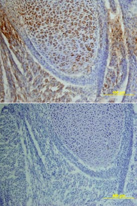 Immunohistochemistry EGFR [p Tyr1173] Antibody [Unconjugated]
