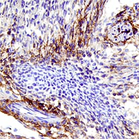 Immunohistochemistry EGFR Antibody [Unconjugated]