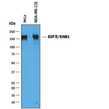 Western Blot EGFR Antibody [Unconjugated]