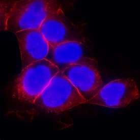 Immunocytochemistry EGFR Antibody [Unconjugated]