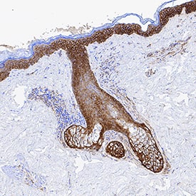 Immunohistochemistry EGFR Antibody [Unconjugated]