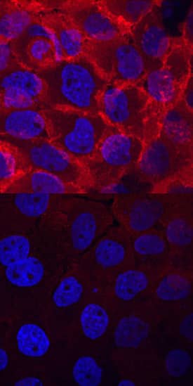 <b>Biological Strategies Validation. </b>EGFR phosphorylated at Y845 was detected in immersion fixed A431 human epithelial carcinoma cell line untreated (lower panel) or treated (upper panel) with pervanadate using Rabbit Anti-Human Phospho-EGFR (Y845) Antigen Affinity-purified Polyclonal Antibody (Catalog # AF3394) at 10 µg/mL for 3 hours at room temperature. Cells were stained using the NorthernLights™ 557-conjugated Anti-Rabbit IgG Secondary Antibody (red; Catalog # NL004) and counterstained with DAPI (blue). View our protocol for Fluorescent ICC Staining of Cells on Coverslips.