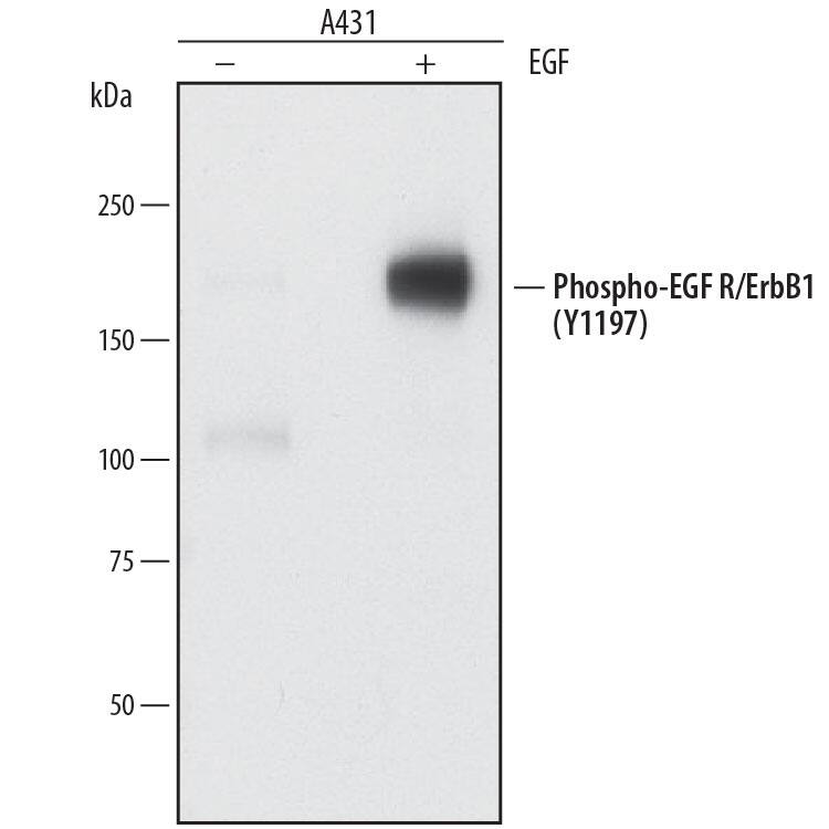 Western blot shows lysates of A431 human epithelial carcinoma cell line untreated (-) or treated (+) with 100 ng/mL Recombinant Human EGF (Catalog # 236-EG) for 5 minutes. PVDF membrane was probed with 0.05 µg/mL of Rat Anti-Human Phospho-EGFR (Y1197) Monoclonal Antibody (Catalog # MAB8058) followed by HRP-conjugated Anti-Rat IgG Secondary Antibody (Catalog # HAF005). A specific band was detected for Phospho-EGFR (Y1197) at approximately 190 kDa (as indicated). This experiment was conducted under reducing conditions and using Immunoblot Buffer Group 1.