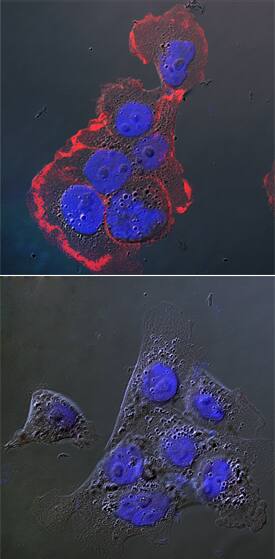 <b>Biological Strategies Validation. </b>EGFR phosphorylated at Y869 was detected in immersion fixed A431 human epithelial carcinoma cell line untreated (lower panel) or treated (upper panel) with Recombinant Human EGF (Catalog # 236-EG) using Rat Anti-Human Phospho-EGFR (Y869) Monoclonal Antibody (Catalog # MAB8130) at 25 µg/mL for 3 hours at room temperature. Cells were stained using the NorthernLights™ 557-conjugated Anti-Rat IgG Secondary Antibody (red; Catalog # NL013) and counterstained with DAPI (blue). Specific staining was localized to plasma membrane upon stimulation. View our protocol for Fluorescent ICC Staining of Cells on Coverslips.