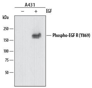 Western blot shows lysates of A431 human epithelial carcinoma cell line untreated (-) or treated (+) with 100 ng/mL Recombinant Human EGF (Catalog # 236-EG) for 5 minutes. PVDF membrane was probed with 0.5 µg/mL of Rat Anti-Human Phospho-EGFR (Y869) Monoclonal Antibody (Catalog # MAB8130) followed by HRP-conjugated Anti-Rat IgG Secondary Antibody (Catalog # HAF005). A specific band was detected for Phospho-EGFR (Y869) at approximately 190 kDa (as indicated). This experiment was conducted under reducing conditions and using Immunoblot Buffer Group 1.