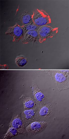 EGFR phosphorylated at Y1197 was detected in immersion fixed A431 human epithelial carcinoma cell line treated (upper panel) or not (lower panel) with EGF (Catalog # 236-EG) using Rat Anti-Human Phospho-EGFR (Y1197) Monoclonal Antibody (Catalog # MAB8274) at 25 µg/mL for 3 hours at room temperature. Cells were stained using the NorthernLights™ 557-conjugated Anti-Rat IgG Secondary Antibody (red; Catalog # NL013) and counterstained with DAPI (blue). Specific staining was localized to plasma membranes. View our protocol for Fluorescent ICC Staining of Cells on Coverslips.