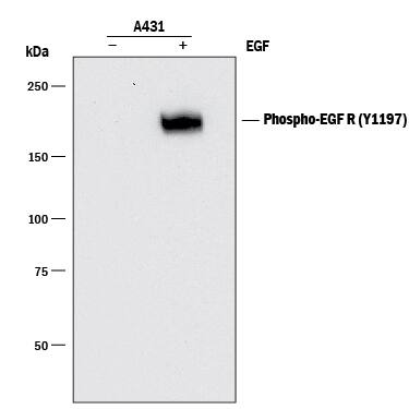 <b>Biological Strategies Validation. </b>Western blot shows lysates of A431 human epithelial carcinoma cell line untreated (-) or treated (+) with 100 ng/mL Recombinant Human EGF (Catalog # 236-EG) for 5 minutes. PVDF membrane was probed with 0.1 µg/mL of Rat Anti-Human Phospho-EGFR (Y1197) Monoclonal Antibody (Catalog # MAB8274) followed by HRP-conjugated Anti-Rat IgG Secondary Antibody (Catalog # HAF005). A specific band was detected for Phospho-EGFR (Y1197) at approximately 190 kDa (as indicated). This experiment was conducted under reducing conditions and using Immunoblot Buffer Group 1.For Western blot applications, Catalog # MAB8058 is recommended.