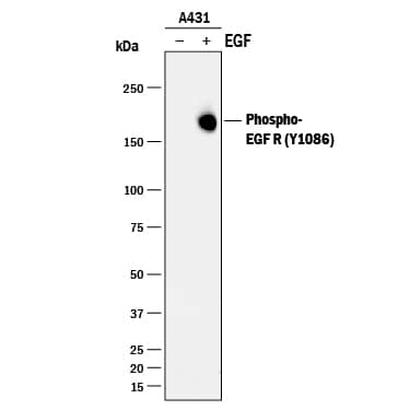 Western blot shows lysates of A431 human epithelial carcinoma cell line untreated (-) or treated (+) with 100 ng/mL Recombinant Human EGF (Catalog # 236-EG) for 5 minutes. PVDF membrane was probed with 1 µg/mL of Rat Anti-Human Phospho-EGFR (Y1086) Monoclonal Antibody (Catalog # MAB89671) followed by HRP-conjugated Anti-Rat IgG Secondary Antibody (Catalog # HAF005). A specific band was detected for Phospho-EGFR (Y1086) at approximately 180 kDa (as indicated). This experiment was conducted under reducing conditions and using Immunoblot Buffer Group 1.