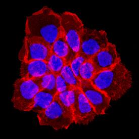 <b>Biological Strategies Validation. </b>EGFR phosphorylated at Y1086 was detected in immersion fixed A431 human epithelial carcinoma cell line treated with Recombinant Human EGF (Catalog # 236-EG) using Rabbit Anti-Human Phospho-EGFR (Y1086) Monoclonal Antibody (Catalog # MAB8967) at a 1 µg/mL for 3 hours at room temperature. Cells were stained using the NorthernLights™ 557-conjugated Anti-Rabbit IgG Secondary Antibody (red; Catalog # NL004) and counterstained with DAPI (blue). Specific staining was localized to cell membrane. View our protocol for Fluorescent ICC Staining of Cells on Coverslips.