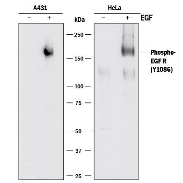 Western blot shows lysates of A431 human epithelial carcinoma cell line and HeLa human cervical epithelial carcinoma cell line untreated (-) or treated (+) with 100 ng/mL Recombinant Human EGF (Catalog # 236-EG) for 5 minutes. PVDF membrane was probed with 0.1 µg/mL of Rabbit Anti-Human Phospho-EGFR (Y1086) Monoclonal Antibody (Catalog # MAB8967) followed by HRP-conjugated Anti-Rabbit IgG Secondary Antibody (Catalog # HAF008). A specific band was detected for Phospho-EGFR (Y1086) at approximately 180 kDa (as indicated). This experiment was conducted under reducing conditions and using Immunoblot Buffer Group 1.