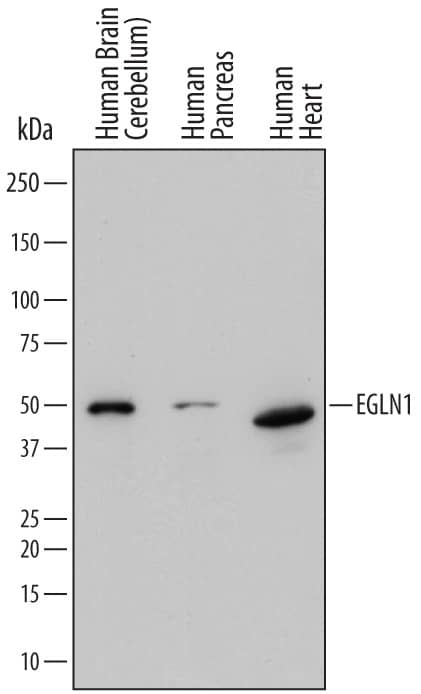 Western blot shows lysates of human brain (cerebellum) tissue, human pancreas tissue, and human heart tissue. PVDF membrane was probed with 0.5 µg/mL of Sheep Anti-Human EGLN1/PHD2 Antigen Affinity-purified Polyclonal Antibody (Catalog # AF7680) followed by HRP-conjugated Anti-Sheep IgG Secondary Antibody (Catalog # HAF016). A specific band was detected for EGLN1/PHD2 at approximately 45-50 kDa (as indicated). This experiment was conducted under reducing conditions and using Immunoblot Buffer Group 1.