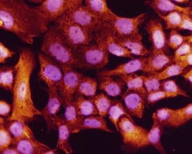 ELF3 was detected in immersion fixed A431 human epithelial carcinoma cell line using 10 µg/mL Human/Mouse ELF3 Antigen Affinity-purified Polyclonal Antibody (Catalog # AF5787) for 3 hours at room temperature. Cells were stained with the NorthernLights™ 557-conjugated Anti-Goat IgG Secondary Antibody (red; Catalog # NL001) and counterstained with DAPI (blue). View our protocol for Fluorescent ICC Staining of Cells on Coverslips.