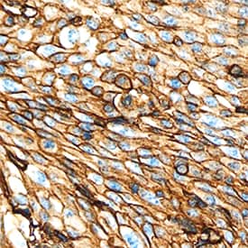EMMPRIN/CD147 was detected in immersion fixed paraffin-embedded sections of human cervix using Goat Anti-Human EMMPRIN/CD147 Antigen Affinity-purified Polyclonal Antibody (Catalog # AF972) at 1 µg/mL overnight at 4 °C. Tissue was stained using the Anti-Goat HRP-DAB Cell & Tissue Staining Kit (brown; Catalog # CTS008) and counterstained with hematoxylin (blue). Specific staining was localized to plasma membranes. View our protocol for Chromogenic IHC Staining of Paraffin-embedded Tissue Sections.
