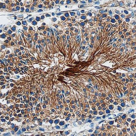 EMMPRIN/CD147 was detected in perfusion fixed frozen sections of mouse testis using Rabbit Anti-Mouse EMMPRIN/CD147 Monoclonal Antibody (Catalog # MAB7721) at 1 µg/mL overnight at 4 °C. Tissue was stained using the Anti-Rabbit HRP-DAB Cell & Tissue Staining Kit (brown; CTS005) and counterstained with hematoxylin (blue). Specific staining was localized to spermatozoa. View our protocol for Chromogenic IHC Staining of Frozen Tissue Sections.