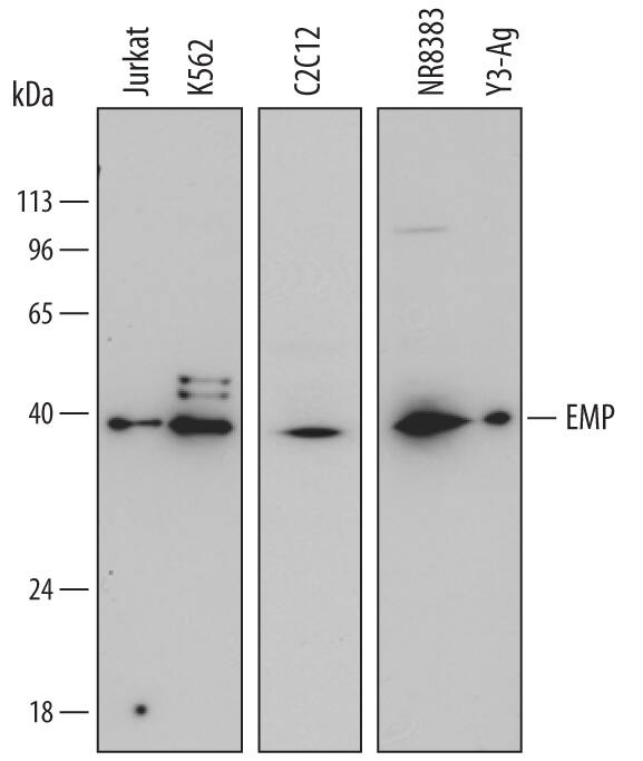Western blot shows lysates of Jurkat human acute T cell leukemia cell line, K562 human chronic myelogenous leukemia cell line, C2C12 mouse myoblast cell line, NR8383 rat alveolar macrophage cell line, and Y3‑Ag rat myeloid cell line. PVDF membrane was probed with 0.5 µg/mL of Mouse Anti-Human/Mouse/Rat EMP/MAEA Monoclonal Antibody (Catalog # MAB7288) followed by HRP-conjugated Anti-Mouse IgG Secondary Antibody (Catalog # HAF007). Specific bands were detected for EMP/MAEA at approximately 36-45 kDa (as indicated). This experiment was conducted under reducing conditions and using Immunoblot Buffer Group 1.