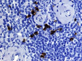 EN-RAGE/S100A12 was detected in immersion fixed paraffin-embedded sections of human tonsil using 10 µg/mL Goat Anti-Human EN-RAGE/ S100A12 Biotinylated Antigen Affinity-purified Polyclonal Antibody (Catalog # BAF1052) overnight at 4 °C. Tissue was stained with the Anti-Goat HRP-DAB Cell & Tissue Staining Kit (brown; Catalog # CTS008) and counterstained with hematoxylin (blue). View our protocol for Chromogenic IHC Staining of Paraffin-embedded Tissue Sections.