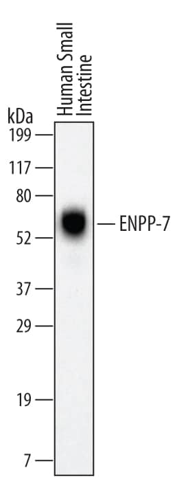 Western blot shows lysates of human small intestine tissue. PVDF Membrane was probed with 2 µg/mL of Mouse Anti-Human ENPP-7/Alk-SMase Monoclonal Antibody (Catalog # MAB4924) followed by HRP-conjugated Anti-Mouse IgG Secondary Antibody (Catalog # HAF007). A specific band was detected for ENPP-7/Alk-SMase at approximately 60 kDa (as indicated). This experiment was conducted under reducing conditions and using Immunoblot Buffer Group 1.