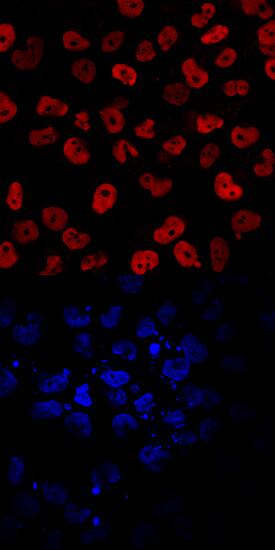 EOMES was detected in immersion fixed BG01V human embryonic stem cells differentiated into mesoderm using Human EOMES Antigen Affinity-purified Polyclonal Antibody (Catalog # AF6166) at 10 µg/mL for 3 hours at room temperature. Cells were stained using the NorthernLights™ 557-conjugated Anti-Sheep IgG Secondary Antibody (red, upper panel; Catalog # NL010) and counterstained with DAPI (blue, lower panel). Specific staining was localized to nuclei. View our protocol for Fluorescent ICC Staining of Cells on Coverslips.