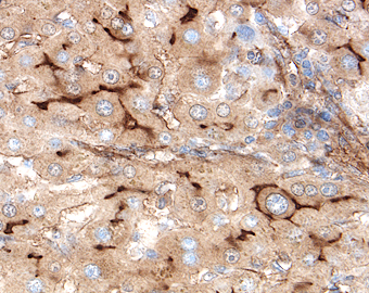 EPCR was detected in immersion fixed paraffin-embedded sections of human liver using 1.7 &micro;g/mL Goat Anti-Human EPCR Antigen Affinity-purified Polyclonal Antibody (Catalog # AF2245) overnight at 4 &deg;C. Tissue was stained with the Anti-Goat HRP-DAB Cell & Tissue Staining Kit (brown; Catalog # CTS008) and counterstained with hematoxylin (blue). View our protocol for Chromogenic IHC Staining of Paraffin-embedded Tissue Sections.