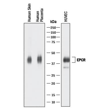 Western Blot EPCR Antibody [Unconjugated]