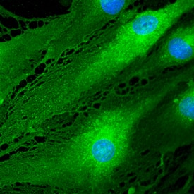 EPCR was detected in immersion fixed bEnd.3 mouse endothelioma cell line using Goat Anti-Mouse EPCR Antigen Affinity-purified Polyclonal Antibody (Catalog # AF2749) at 10 µg/mL for 3 hours at room temperature. Cells were stained using the NorthernLights™ 493-conjugated Anti-Goat IgG Secondary Antibody (green; Catalog # NL003) and counterstained with DAPI (blue). Specific staining was localized to cytoplasm. View our protocol for Fluorescent ICC Staining of Cells on Coverslips.