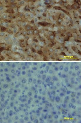 EPCR was detected in immersion fixed paraffin-embedded sections of human liver array using Goat Anti-Human EPCR Biotinylated Antigen Affinity-purified Polyclonal Antibody (Catalog # BAF2245) at 15 µg/mL overnight at 4 °C. Tissue was stained using the Anti-Goat HRP-DAB Cell & Tissue Staining Kit (brown; Catalog # CTS008) and counterstained with hematoxylin (blue). Lower panel shows a lack of labeling if primary antibodies are omitted and tissue is stained only with secondary antibody followed by incubation with detection reagents. View our protocol for Chromogenic IHC Staining of Paraffin-embedded Tissue Sections.
