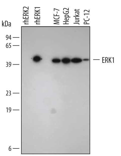 Western Blot ERK1 Antibody [Unconjugated]