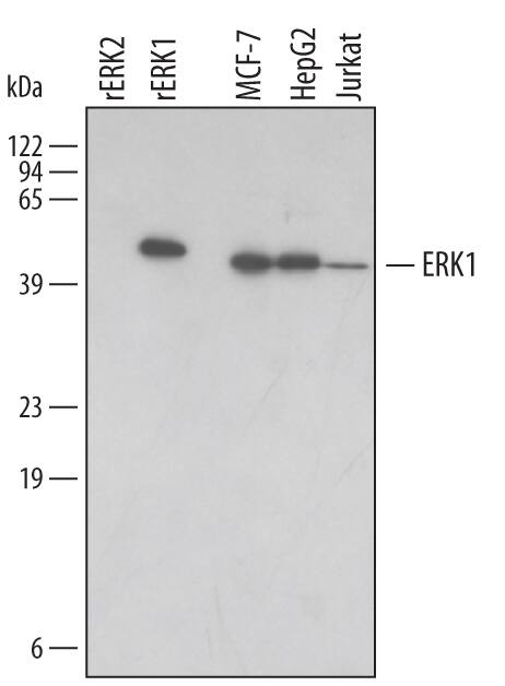 Western blot shows lysates of MCF-7 human breast cancer cell line, HepG2 human hepatocellular carcinoma cell line, and Jurkat human acute T cell leukemia cell line. PVDF membrane was probed with 0.2 µg/mL Goat Anti-Human ERK1 Antigen Affinity-purified Polyclonal Antibody (Catalog # AF1879) followed by HRP-conjugated Anti-Goat IgG Secondary Antibody (Catalog # HAF109). For additional reference, Recombinant Human Active ERK1 (Catalog # 1879-KS) and Recombinant Human Active ERK2 (Catalog # 1230-KS) (2 ng/lane) were included. A specific band for ERK1 was detected at approximately 43 kDa (as indicated). This experiment was conducted under reducing conditions and using Immunoblot Buffer Group 1.