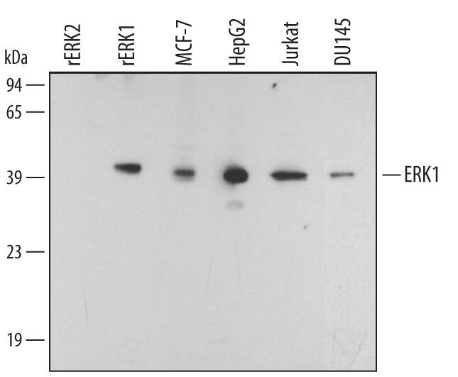 Western blot shows lysates of MCF-7 human breast cancer cell line, HepG2 human hepatocellular carcinoma cell line, Jurkat human acute T cell leukemia cell line, and DU145 human prostate carcinoma cell line. PVDF membrane was probed with 0.1 µg/mL Rabbit Anti-Human ERK1 Antigen Affinity-purified Polyclonal Antibody (Catalog # AF1940) followed by HRP-conjugated Anti-Rabbit IgG Secondary Antibody (Catalog # HAF008). For additional reference, Rec-ombinant Human Active ERK1 (Catalog # 1879-KS) and Recom-binant Human Active ERK2 (Catalog # 1230-KS) (2 ng/lane) were included. A specific band for ERK1 was detected at approximately 42 kDa (as in-dicated). This experiment was conducted under reducing conditions and using Immunoblot Buffer Group 1.