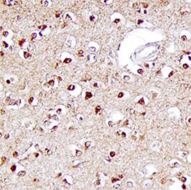 ERK1/ERK2 was detected in immersion fixed paraffin-embedded sections of human brain (cortex) using Mouse Anti-Human/Mouse/Rat ERK1/ERK2 Monoclonal Antibody (Catalog # MAB1576) at 15 µg/mL overnight at 4 °C. Tissue was stained using the Anti-Mouse HRP-DAB Cell & Tissue Staining Kit (brown; Catalog # CTS002) and counterstained with hematoxylin (blue). Specific staining was localized to neuronal cell bodies. View our protocol for Chromogenic IHC Staining of Paraffin-embedded Tissue Sections.
