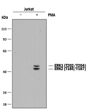Western Blot ERK1 [p Thr202, p Tyr204, p Thr185, p Tyr187] Antibody (1088B) [Unconjugated]