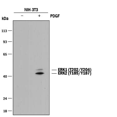 Western Blot ERK1 [p Thr202, p Tyr204, p Thr185, p Tyr187] Antibody (1088B) [Unconjugated]