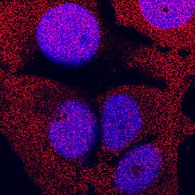 ERK1 was detected in immersion fixed MCF-7 human breast cancer cell line using Mouse Anti-Human ERK1 Monoclonal Antibody (Catalog # MAB1940) at 0.3 µg/mL for 3 hours at room temperature. Cells were stained using the NorthernLights™ 557-conjugated Anti-Mouse IgG Secondary Antibody (red; Catalog # NL007) and counterstained with DAPI (blue). Specific staining was localized to cytoplasm and nuclei. View our protocol for Fluorescent ICC Staining of Cells on Coverslips.