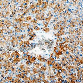 ERK1 was detected in immersion fixed paraffin-embedded sections of human liver using Mouse Anti-Human ERK1 Monoclonal Antibody (Catalog # MAB1940) at 15 µg/mL overnight at 4 °C. Tissue was stained using the Anti-Mouse HRP-DAB Cell & Tissue Staining Kit (brown; Catalog # CTS002) and counterstained with hematoxylin (blue). Specific staining was localized to cytoplasm in hepatocytes. View our protocol for Chromogenic IHC Staining of Paraffin-embedded Tissue Sections.